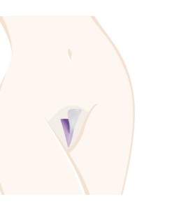 Sextoys, sexshop, loveshop, lingerie sexy : Rasage intime : Pochoir Rasage Intime LADYSHAPE Triangle